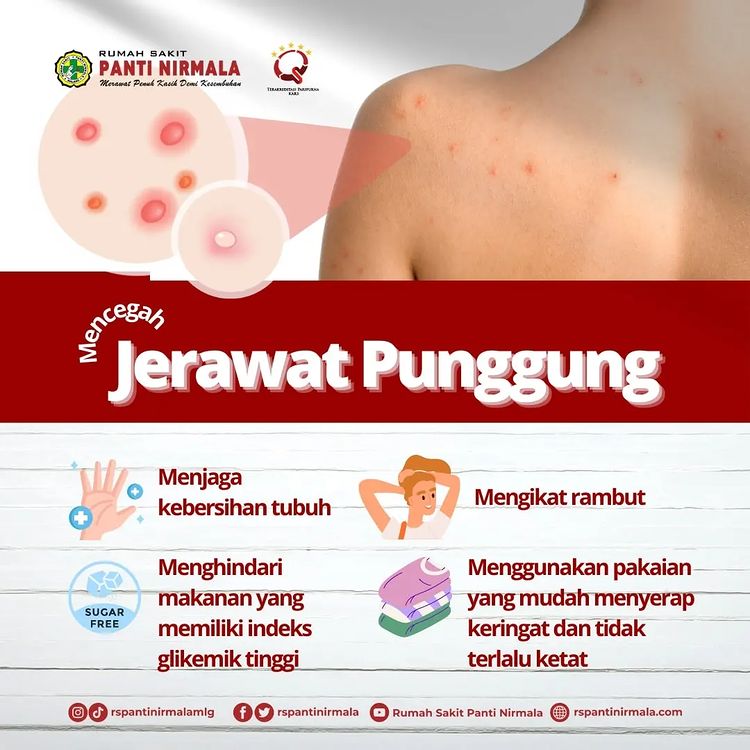 Jerawat di punggung terbentuk ketika sebum ekstra dan sel-sel kulit mati menumpuk.