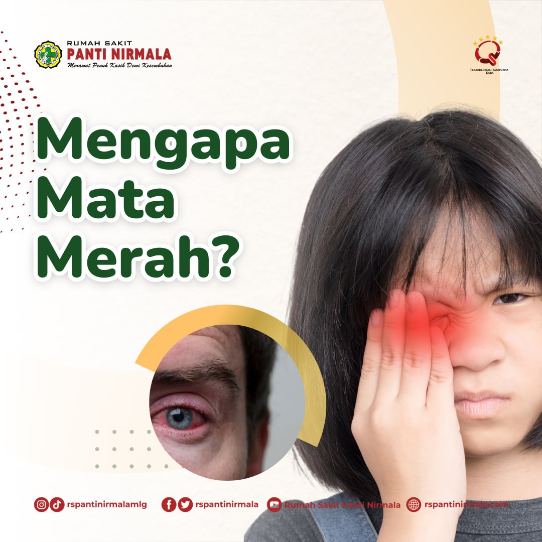 Mengapa Mata Merah?