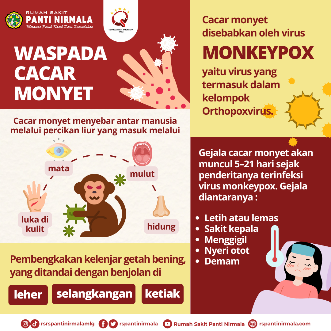 Monkeypox (Cacar Monyet)