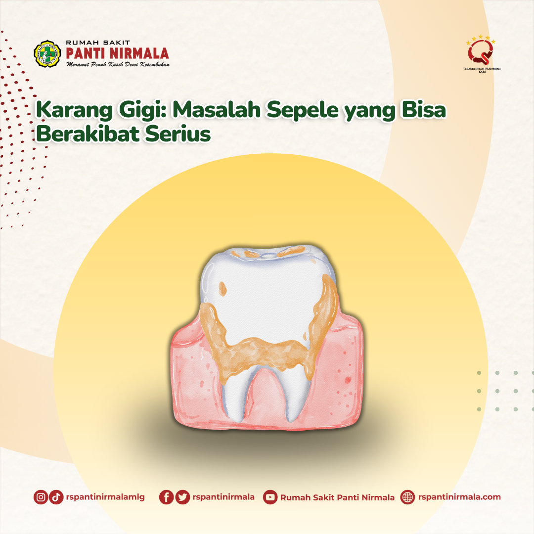Karang Gigi: Masalah Sepele yang Bisa Berakibat Serius