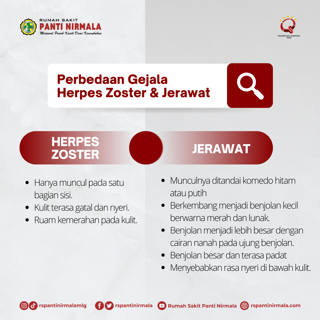 Perbedaan Gejala Herpes Zoster dan jerawat