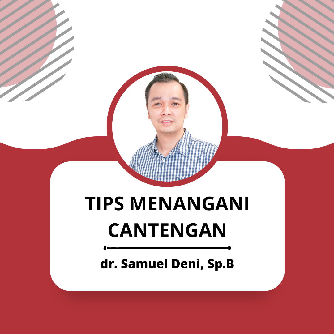 TIPS MENANGANI CANTENGAN