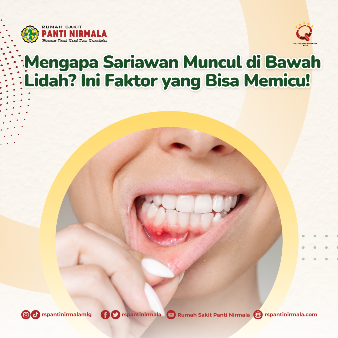 Mengapa Sariawan Muncul di Bawah Lidah? Ini Faktor yang Bisa Memicu!