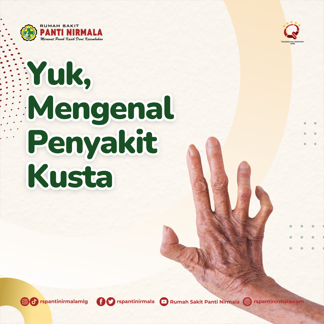 Mengenal Penyakit Kusta Dan Faktor Resiko Penyakit Kusta Yang Sobat Nirmala Wajib KetahuI!