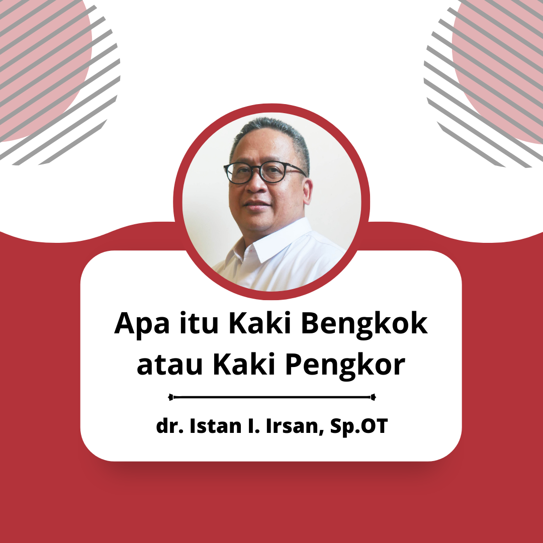 Apa itu Kaki Bengkok atau Kaki Pengkor